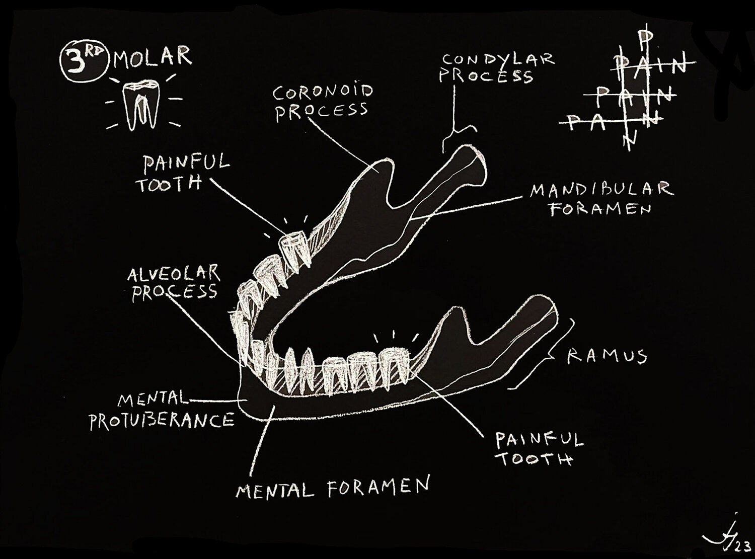 Jaw bone 02 Julien Hayot