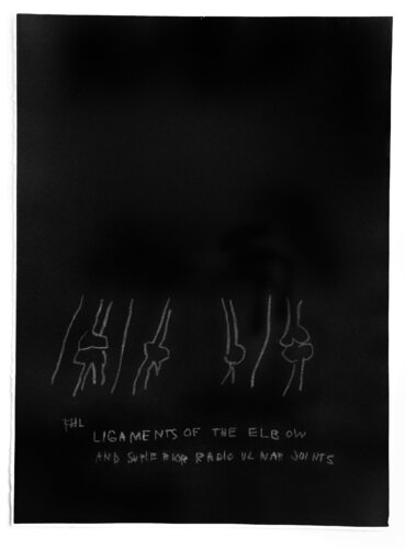 Ligaments of the Elbow von Jean-Michel Basquiat, Druck kaufen auf Singulart
