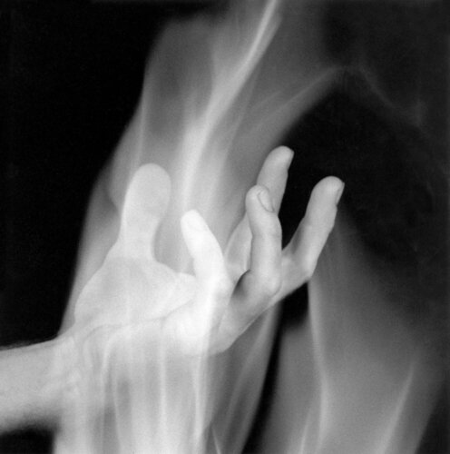 Hand In Fire van Robert Mapplethorpe, Fotografie te koop op Singulart