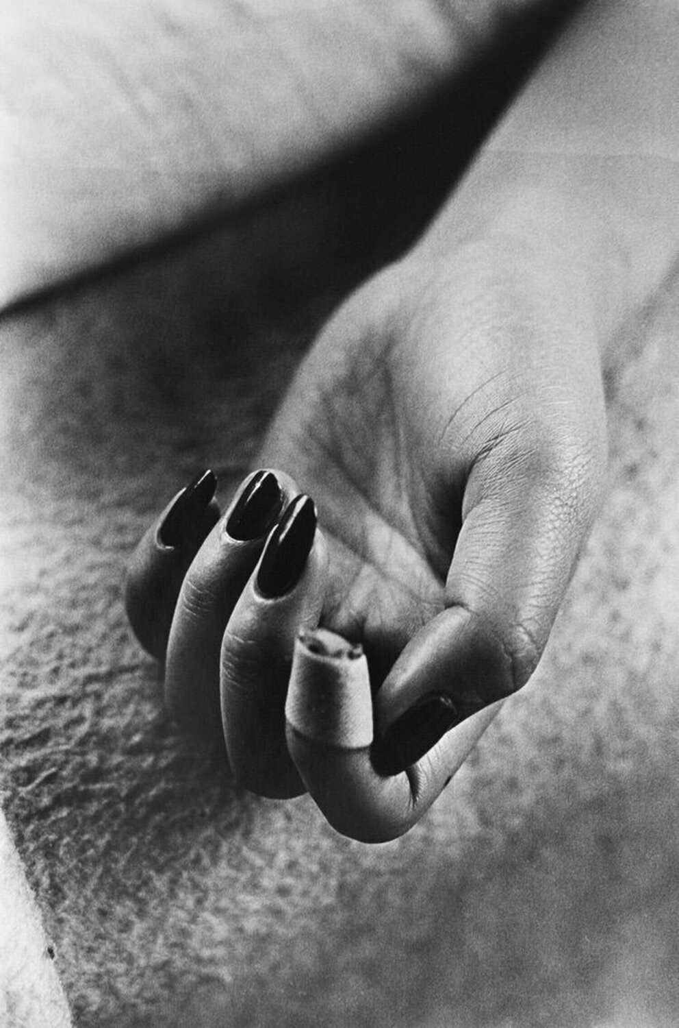 Bandaged Finger Daido Moriyama Fotografia in vendita
