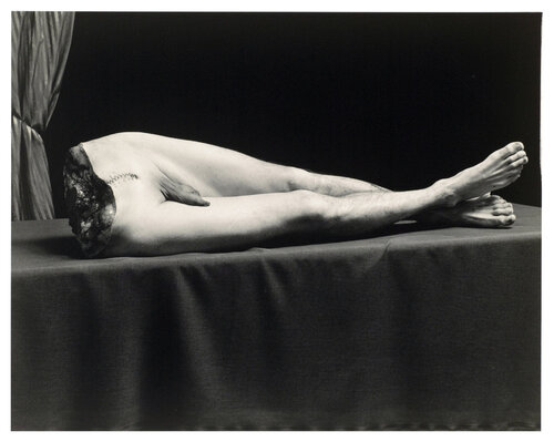 Corpus Medius van Joel-Peter Witkin, Fotografie te koop op Singulart