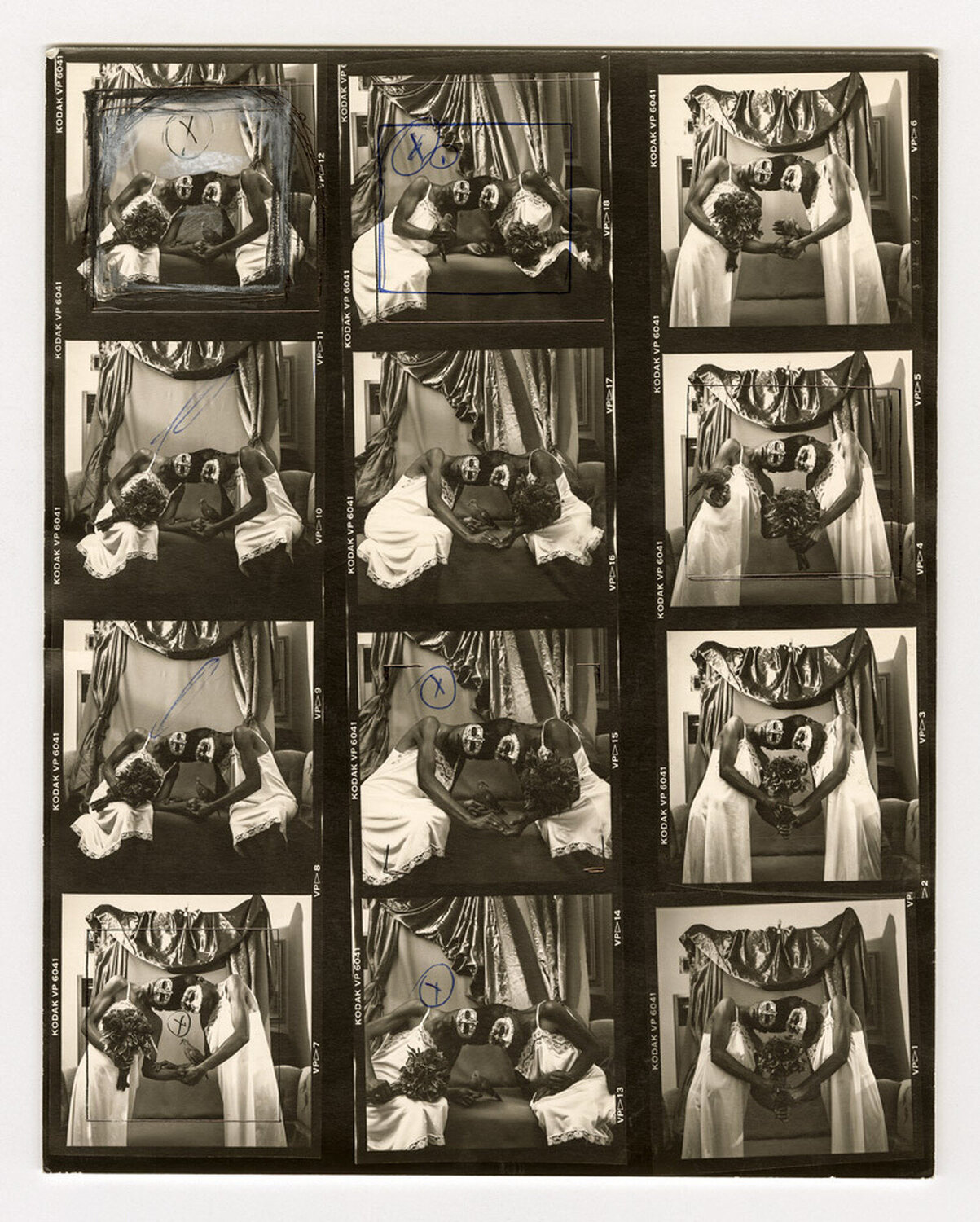 Siamese Twins, Los Angeles Joel-Peter Witkin Fotografie zu verkaufen
