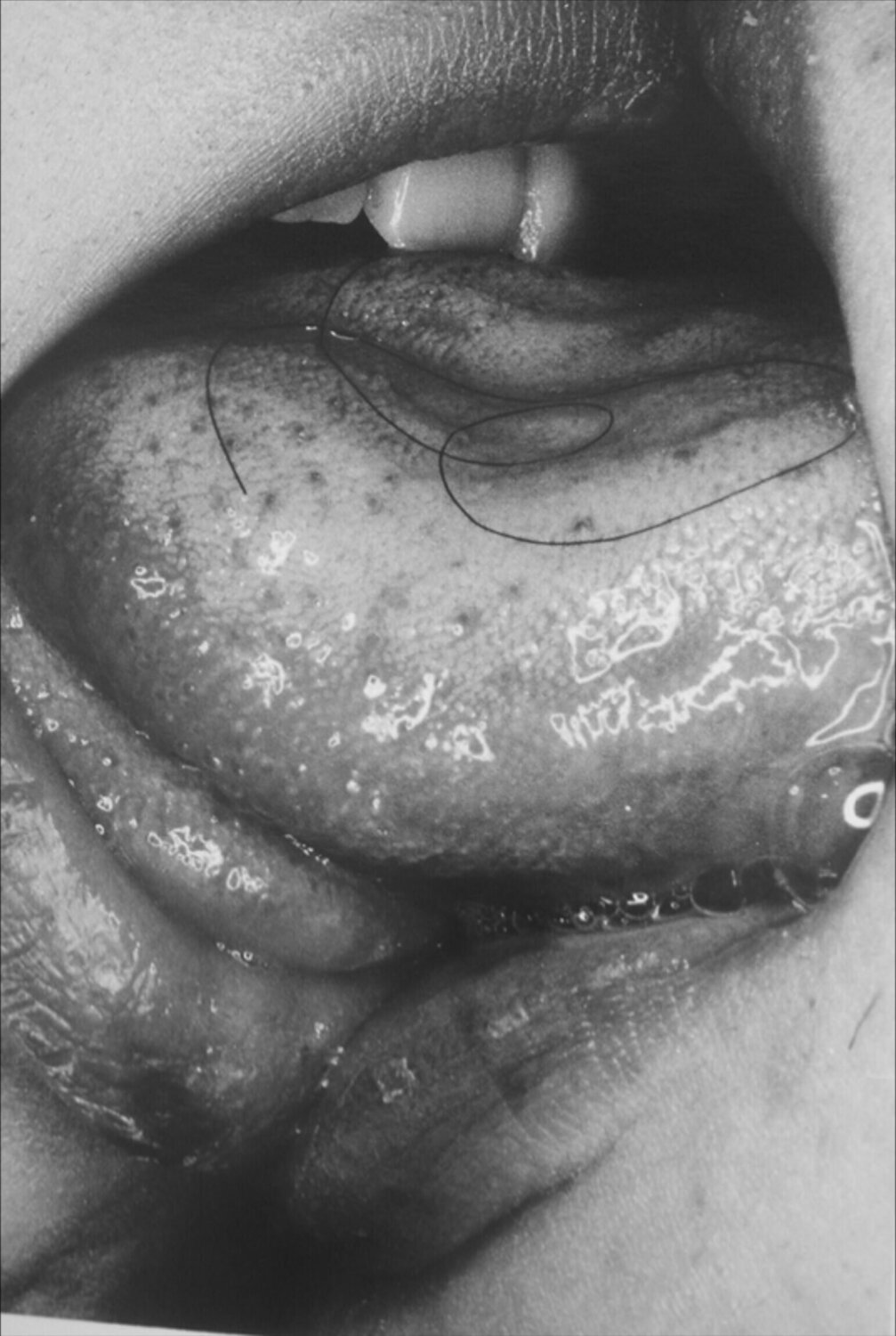 Untitled (Erotos) Nobuyoshi Araki