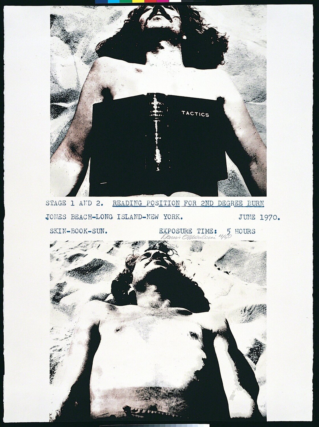 Reading position for second degree burn Dennis Oppenheim Stampa in vendita