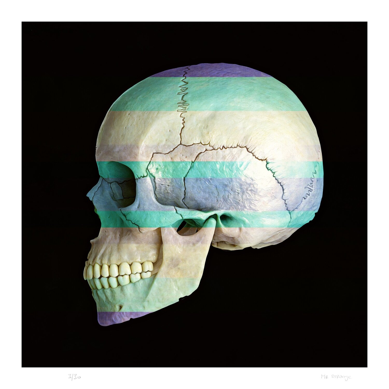 Decorated Human Skull I Jean-Marie Gitard