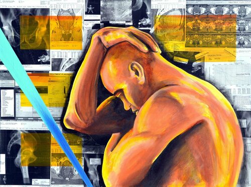 Prostate Analysis von Joe LaMattina, Malerei kaufen auf Singulart