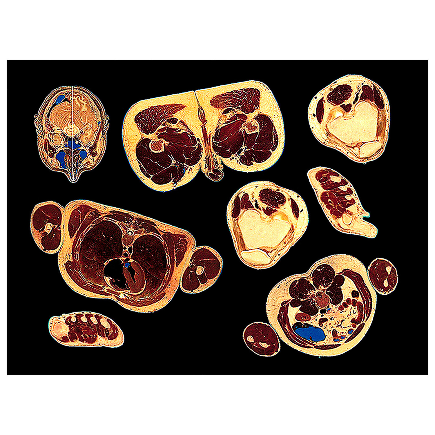 "Work # 570: Cuts of Meat" Bruce Eves