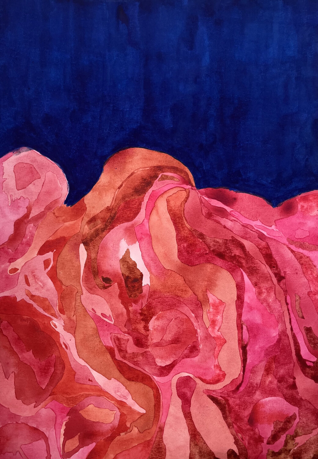 Inflammation Roxanne Louise Pinto Hjorth