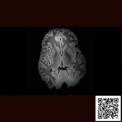 Symphony of Perception Vol 1, 2019 - 2020 (Digital multimedia experience) by Michalina Marta Cap, Other Media for Sale on Singulart