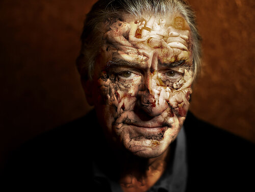 Hot Skin -  Robert Gianluca Chiodi